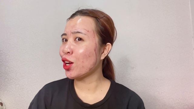 Lần đầu thử peel da tại nhà với SO'NATURAL RED PEEL TINGLE SERUM | Màn peel da gây quạo! смотреть онлайн