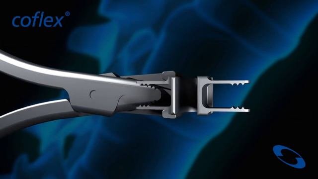 Coflex  - межостистый фиксатор. Устанавливается для разгрузки смежных сегментов пдс.