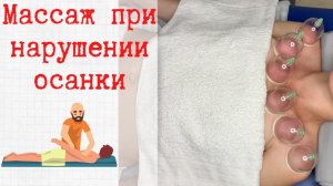Массаж для устранения сутулой осанки. Как убрать сутулость? Причины сутулости. #сколиоз #сутулость