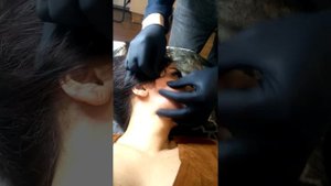 Сепарация тканей. Избавление от рубцов. Обучение