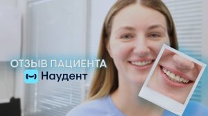 Отзыв пациента клиник Наудент после комплексного лечения