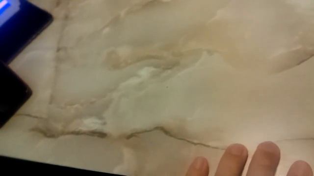 Разыв сухожилий, локтевого и срединного нерва смотреть онлайн