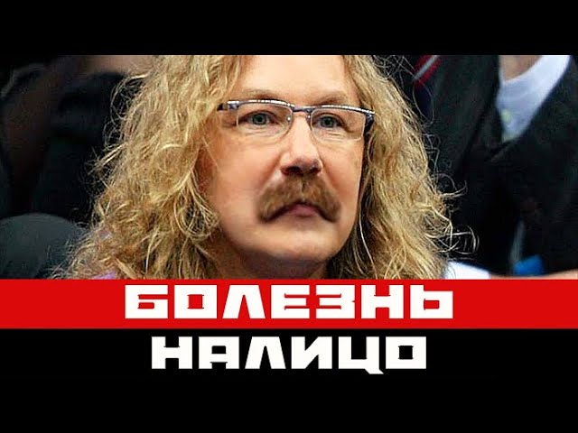 Болезнь Николаева уже не скрыть - диагноз артиста налицо