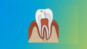 Зачем менять пломбы если зуб не беспокоит