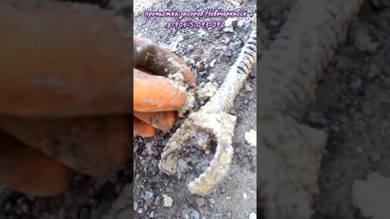 Жировые запасы
