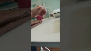 Снятие аппарата илизарова