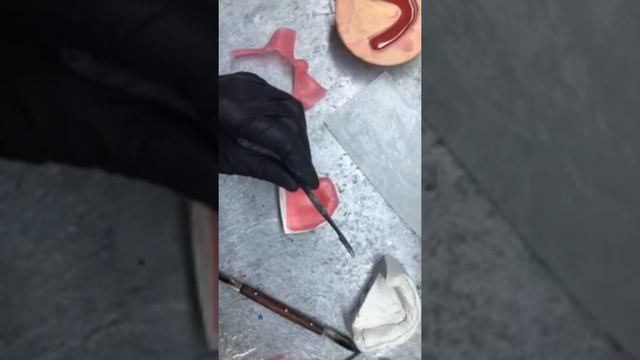 Изготовление валика на полный съёмный протез