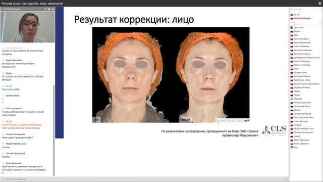 Рельеф кожи как сделать кожу идеальной смотреть онлайн