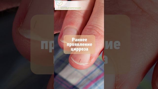 Как печень подаёт сигналы через кожу, ногти и волосы