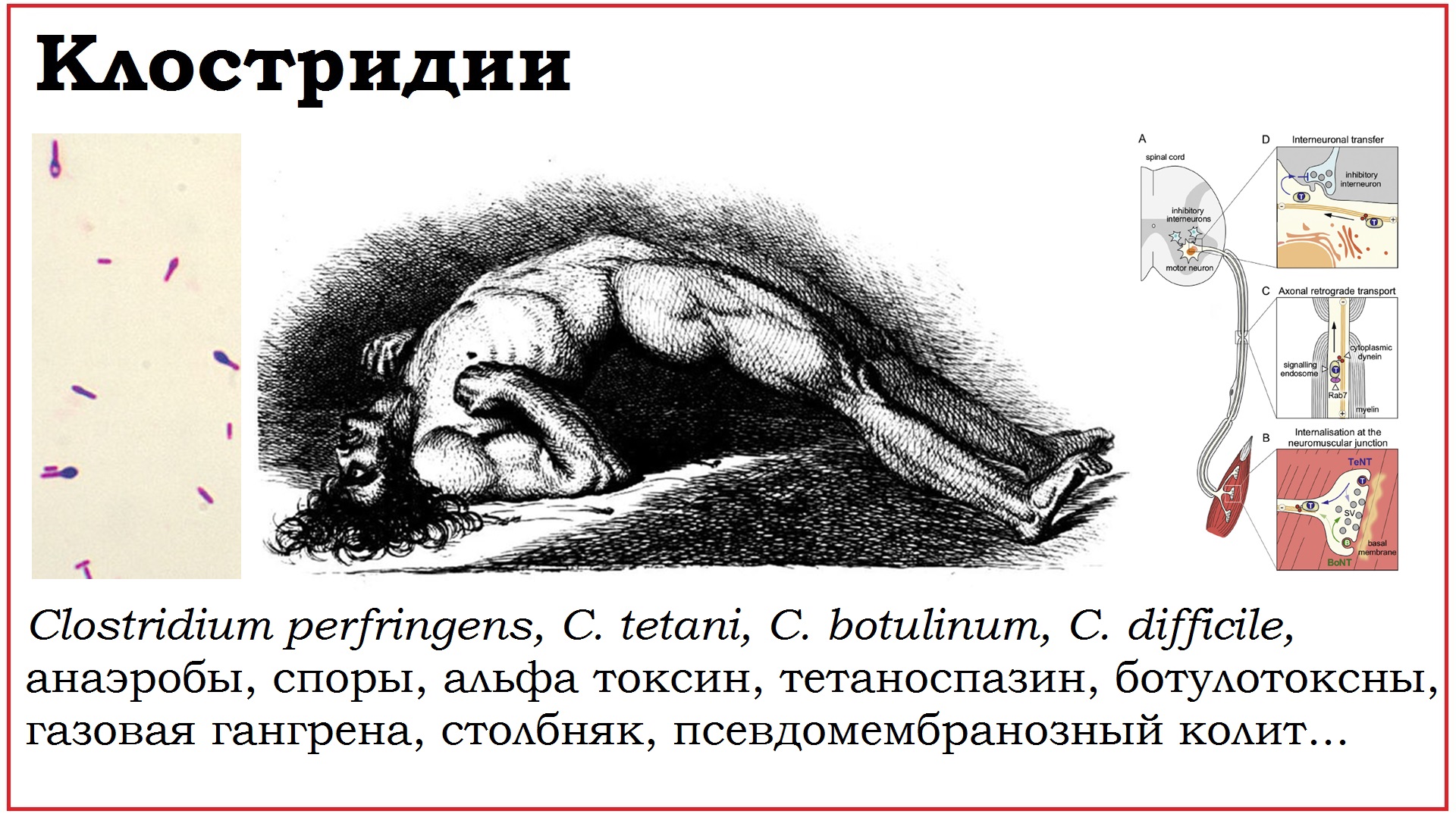 23. Клинически значимые бактерии рода Clostridium