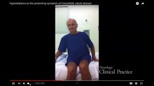 NPSH - Неэпилептические пароксизмы у детей раннего возраста YouTube