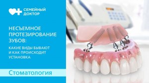 Несъемное протезирование зубов: какие бывают виды и как происходит установка.