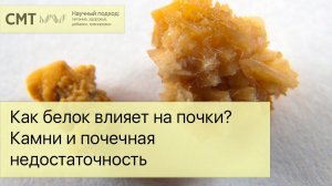 Как белок влияет на почки? Камни и почечная недостаточность