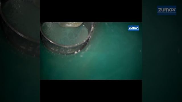 Пломбировка корневого канала зуба биокерамическим силером смотреть онлайн