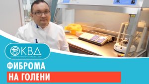 ? Фиброма на голени. Клинический случай №177