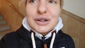 Брекеты. Изменение прикуса. Дополнение