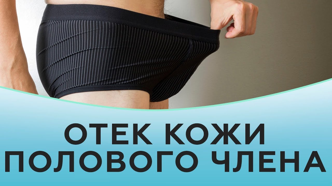 Отек кожи полового члена