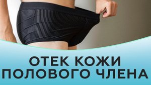 Отек кожи полового члена