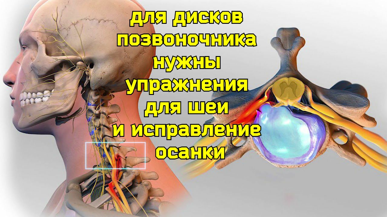 Грыжи и протрузии в шейном отделе позвоночника. С5 6 шейного отдела позвоночника. Грыжа дисков с5 с6 шейного отдела. С6-с7 шейного отдела. Протрузия с5-с6.