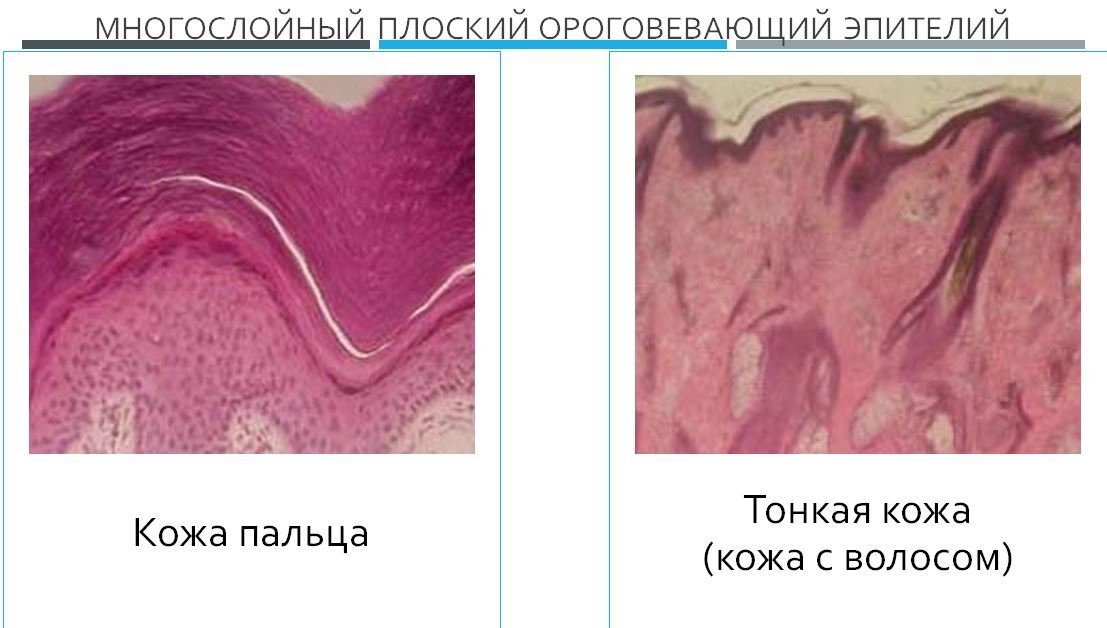 Многослойный плоский ороговевающий эпителий кожи пальца рисунок