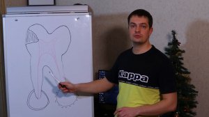 Периодонтит - киста и гранулема зуба - отличия, причины и этапы формирования - прогнозы лечения