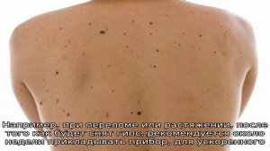 Что такое пленка полимедэл