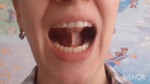 Упражнение грибок. Артикуляционная гимнастика.  Занятия с логопедом для детей.