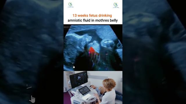 How many weeks are you pregnant? #pregnant #fetus #drinking #amniotic #fluid #pregnant #ultrasound