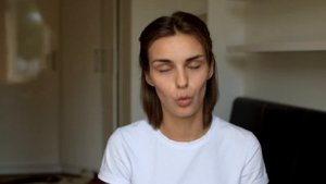 Вылечить прыщи ДО И ПОСЛЕ 15 дней после лечения Акнекутаном(роаккутан)