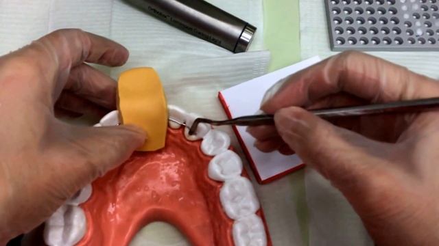 Непрямая фиксация ретейнера. смотреть онлайн