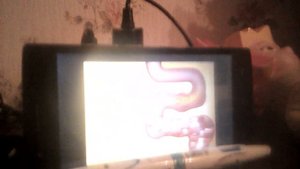 Реклама Эспумизан (2017)