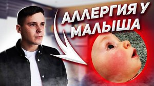 Пищевая аллергия у ребенка / Причины пищевой аллергии