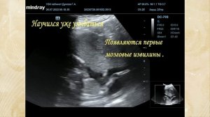 В ожидании рождения малыша. День за днем
