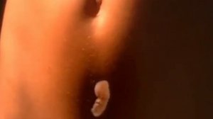 Что нужно знать о гормональной контрацепции