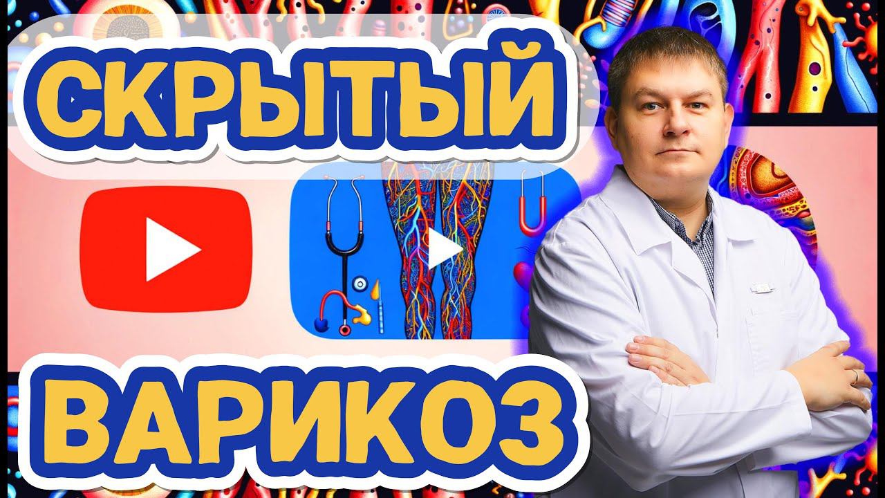 Варикоз на ногах: скрытые симптомы и советы хирурга-флеболога