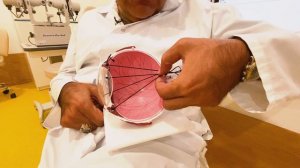 АСТИГМАТИЗМ — НЕ ПРИГОВОР. КАК ПРОХОДИТ ДИАГНОСТИКА И ЛЕЧЕНИЕ