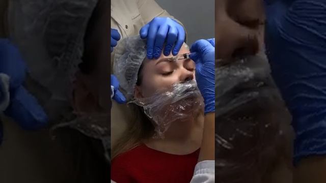 как филлером поднять брови! фрагмент обучения смотреть онлайн