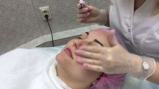 Лифтинг лица. RF лифтинг. смотреть онлайн