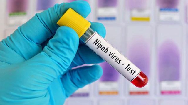 Nipah Virus: Everything You Need To Know