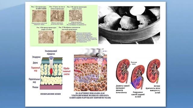 УЗИ в беременность: польза или вред? Можно ли делать УЗИ беременной женщине? - И. Воскресенская смотреть онлайн