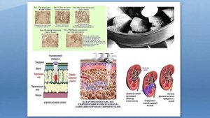 УЗИ в беременность: польза или вред? Можно ли делать УЗИ беременной женщине? - И. Воскресенская