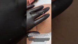 Как правильно делать шугаринг - Типичные ошибки при шугаринге - Как убирать вросшиеся волосы