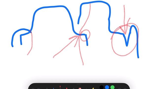 Гравировка зубов всех видео препарирования и оттисков. Стоматолог, зубной техник. смотреть онлайн