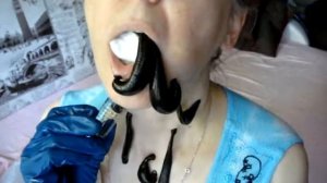 постановка пиявок на нёбо