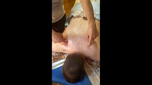 Миопрессура ("самомассаж") дома. Головная боль и боль в шее. Часть 2.