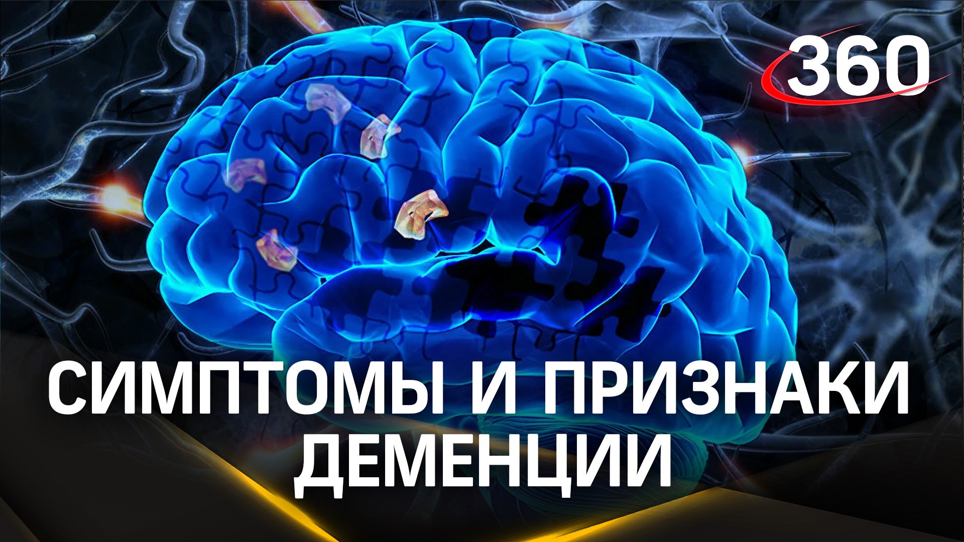 Деменция. Стоит ли бояться или можно предупредить развитие?