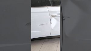 Удаления вмятин без покраски на автомобиле Hyundai Sonata | Ремонт вмятины на двери
