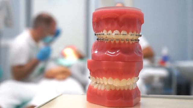 Ортодонтия в «Клинике Пасман» смотреть онлайн