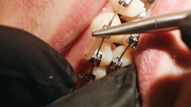 Шайхаттарова Наталья Александровна, главный врач детской клиники РеСто, ортодонт смотреть онлайн