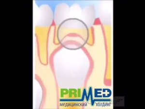 КАК ПРОИСХОДИТ СМЕНА МОЛОЧНОГО ЗУБА НА ПОСТОЯННЫЙ? СТОМАТОЛОГИЯ PRIMEDKIDS